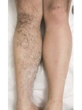 ケトリーナ/ブラジリアンワックス　ワックス