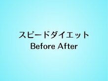 リクラ(Reclat)/まさにスピードダイエット