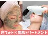 【再来向け】ハーブピーリング＆フォトマシンの最強コラボ☆★