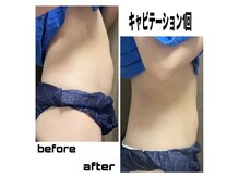 お客様に合わせたダイエット方法を一人一人提案していきます。