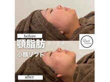 サロン ルイス アディクト(salon Lewis Addict)