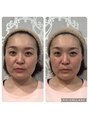 ブーケ(Bouquet)&nbsp;コルギ1回のみの劇的変化！ぜひ体感していただきたいです★