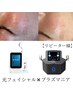 【メニューコラボ】光フェイシャル＆プラズマニアのセット☆導入美容液付き