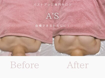 エース(As)の写真