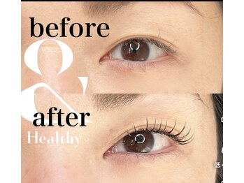 チャミュエル/アンドヘルシー100本10,500円