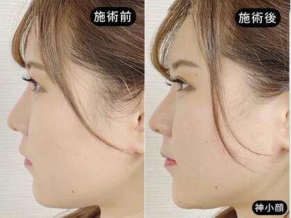 アオヤマ サロン ワイゼット(AOYAMA SALON YZ)の写真