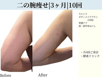 京都フォーエイチ(京都4H)/ブライダルエステに大人気