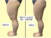 アオレニア(ao.lenia)/強圧マッサージでスッキリ美脚へ