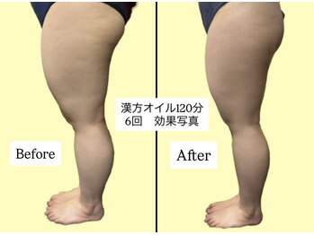 アオレニア(ao.lenia)/強圧マッサージでスッキリ美脚へ