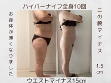 フォーユー マシバメディカル(For You Mashiba Medical)/５０代のお客様。－１５センチ