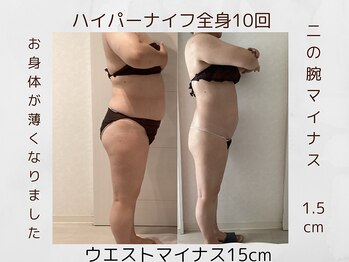 フォーユー マシバメディカル(For You Mashiba Medical)/５０代のお客様。－１５センチ