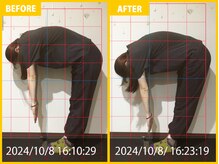 整体院 元 宇城松橋店/姿勢改善で来院