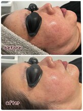 ケースタイル(k.style)/光フォトbefore after