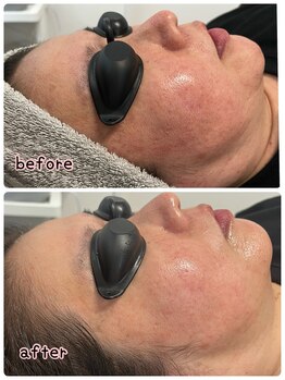 ケースタイル(k.style)/光フォトbefore after