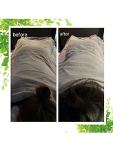 サロン ド リアン(Salon de lien)/ビフォーアフター/整体/肩こり