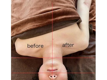 オンプラス(on+)/復元!ビフォーアフター