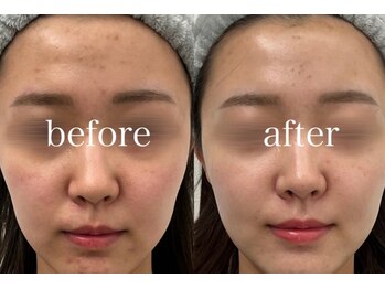 ラポール 野並店(Rapport)/