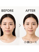 ビテ(Bite)/30代　会社員