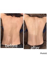 バーン 長崎 諫早(BURN)/ハイパーナイフbeforeafter☆