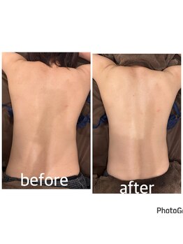 バーン 長崎 諫早(BURN)/ハイパーナイフbeforeafter☆