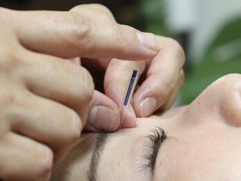 ティルナノーグイリニ(Tir Na Nog-EIRINI)/目も顔もスッキリ