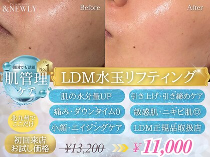 アンドニューリー(&NEWLY)の写真