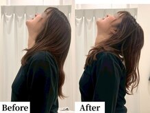 ソレア(Solea)/首こり・肩こり・姿勢改善１回目