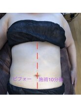シンシア(SINCERE)/部分シェイプ20分