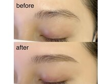 アイプリーム 恵比寿(Eyepreme)/眉毛施術Before&After写真