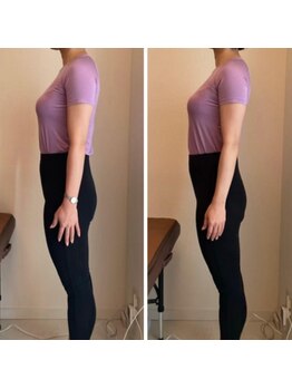 ザ エスアップ 博多店(THE S-UP)/施術前後写真