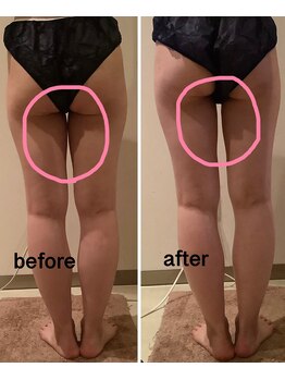 クレアボディ(CREA BODY)/太ももふくらはぎ