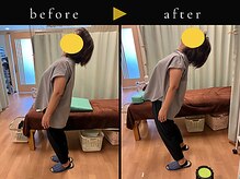 杉本接骨鍼灸院/背骨から全身がユルユル整体