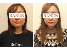 池袋東口整体院/小顔矯正×ハイパーナイフ