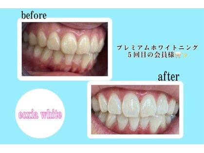 エクシアホワイトニング 倉敷店の写真