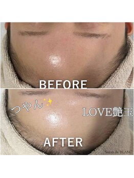 サロン ド ブラン アオヤマ(Salon de BLANC AOYAMA)/クリスティーナイラストリアス