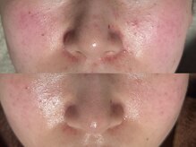 リボーン(REBORN)/続ける事での変化