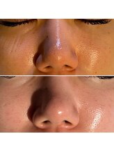 レアリゼ(Realiser)/クレンジングを変えるだけでも！