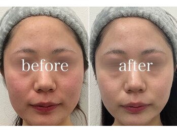 ラポール 野並店(Rapport)/