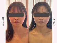 ビューティースタジオ エイワン(A1)の雰囲気（Before/After★小顔矯正＆リンパマッサージ+フォーカスソニック）