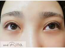 アンドリタ/超ダメージレス　マツパ