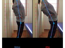 げんじろう針灸接骨院/可動域のビフォーアフター