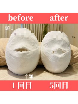 ロータス ビューティー(LOTUS Beauty)/石膏パックビフォーアフター