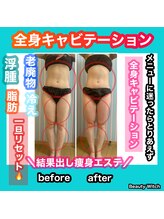 ビューティ ウィッチ(Beauty Witch)/