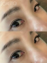 エガリテ(EGALite)/バインドロック