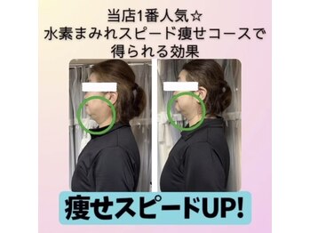 ヨサパーク ナナラーレア 福島店(YOSA PARK nanala lea)/痩身/ダイエット/リンパ/水素