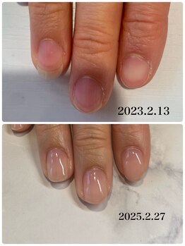 ネロリ(Neroli)/自爪育成