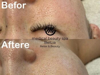 ベリア 広尾(BelLia)/レストセルトリートメント