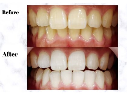 LBSホワイトニング 渋谷店の写真