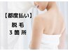 女性 【都度払い脱毛】パーツ別脱毛どこでも3箇所 5280円