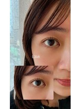 スーコ アイビューティー(suco)/